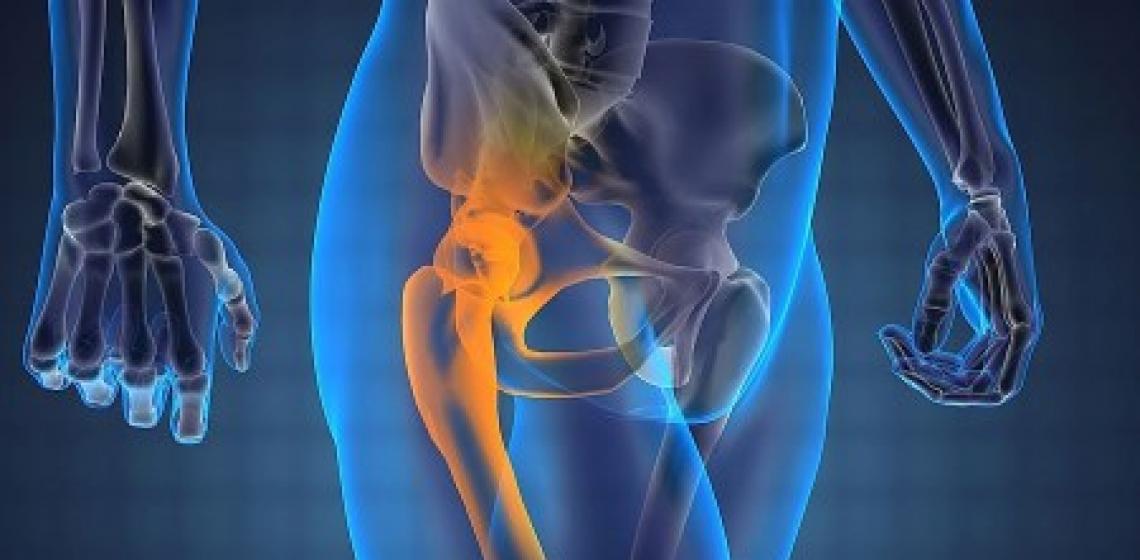 Методи лікування остеохондрозу стегна: медикаменти, масаж, фізіопроцедури, операція, ЛФК та ​​народні засоби